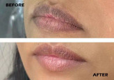 سرم کنسانتره گلوتاتیون گوجیک اسید دکتر مینایر