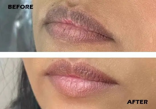 سرم کنسانتره گلوتاتیون گوجیک اسید دکتر مینایر